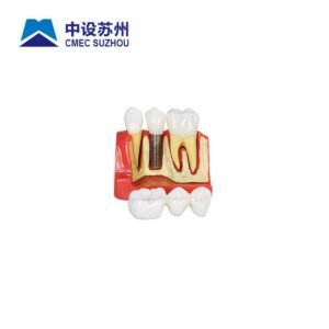 em4028